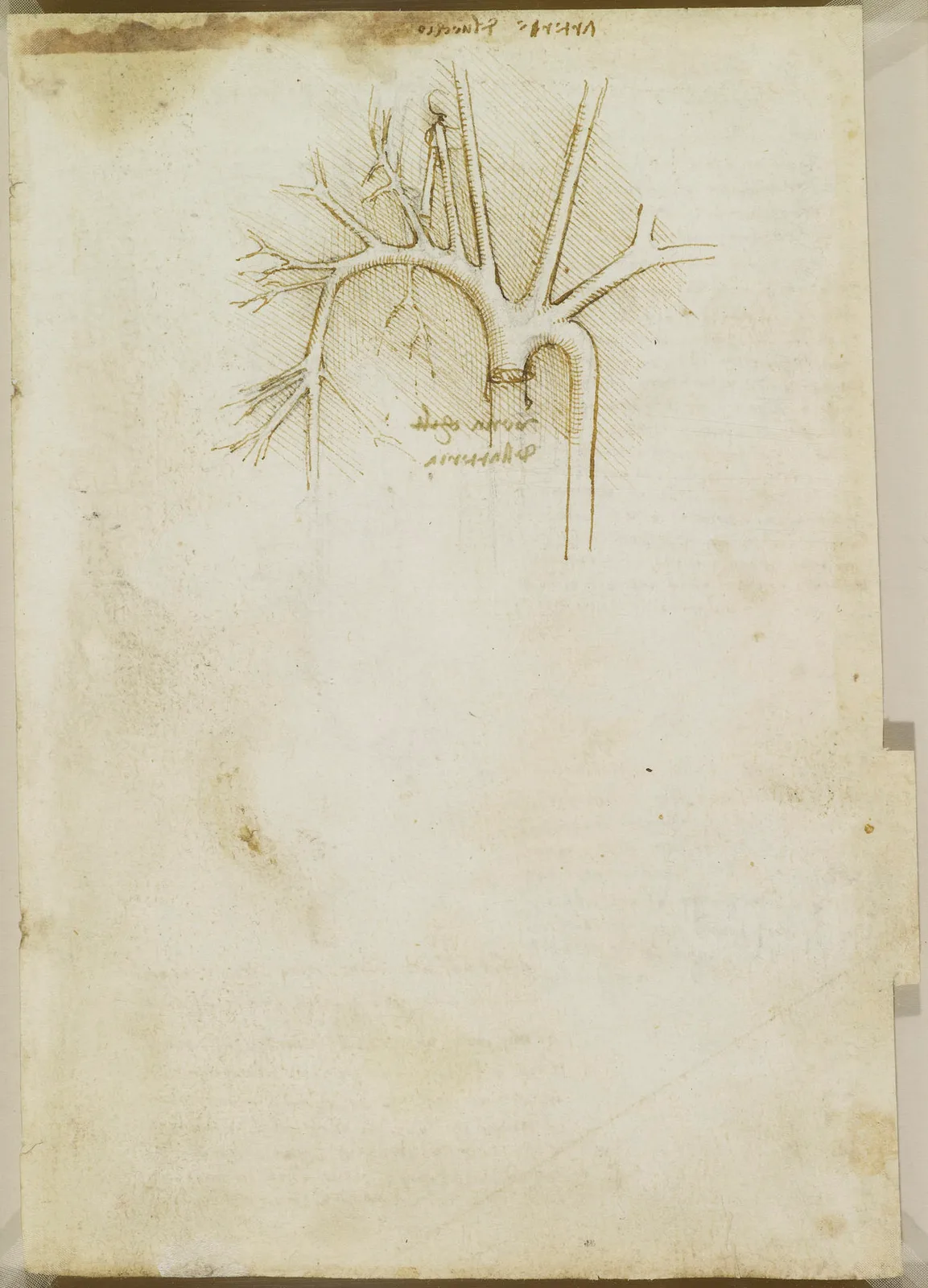 Anatomical Drawing of the Aortic Arch